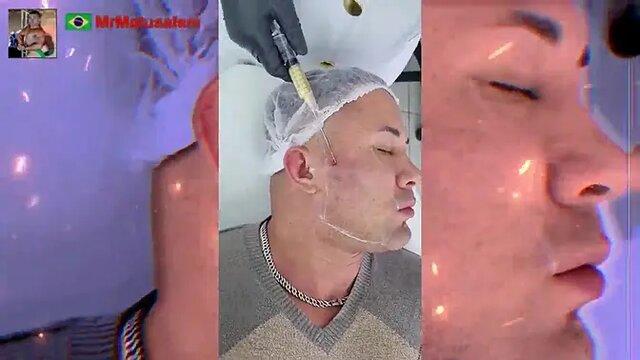 Motivation I transformed myself with facial harmonization see the result